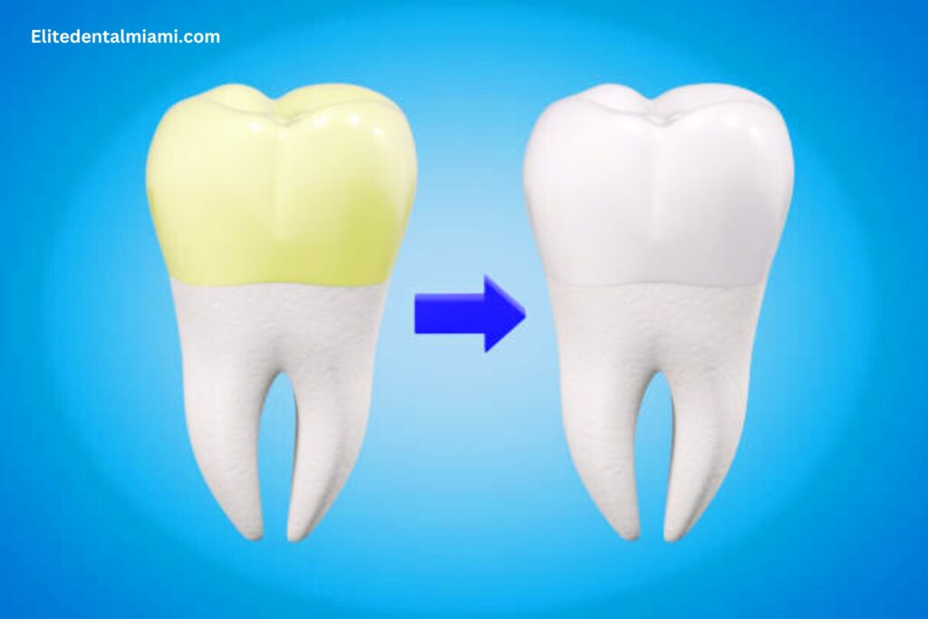 disadvantages of deep cleaning teeth