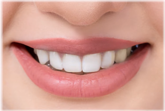 Teeth Whitening,Damage Enamel,Will Teeth Whitening Damage Enamel
